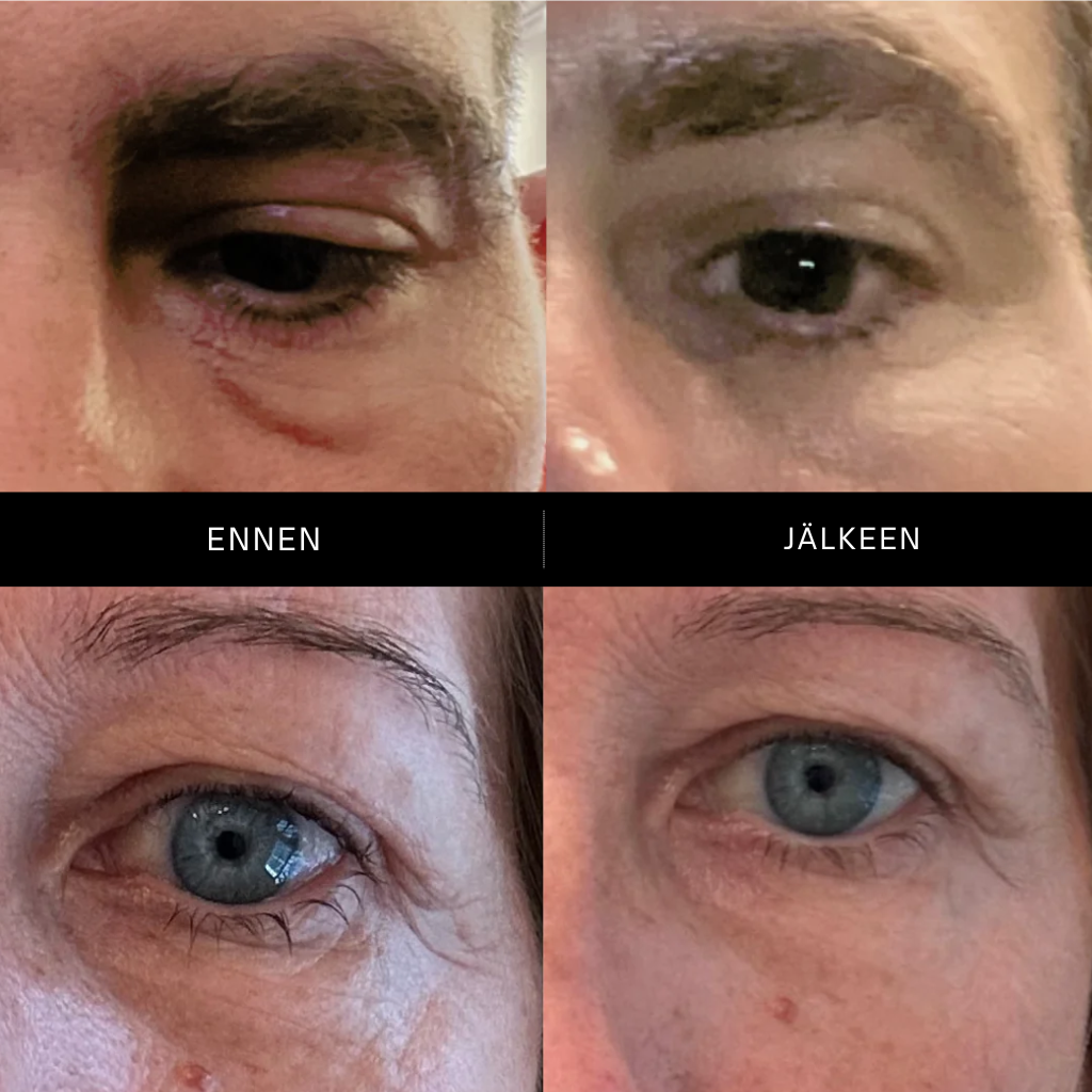 Maya Chia | The Advanced Eye Response Complex Retinol Cream - Naturelle.fi