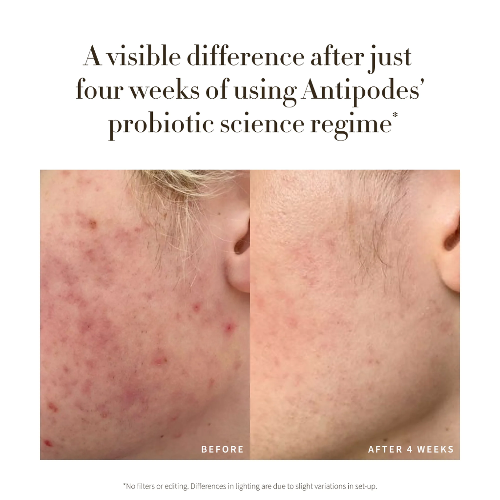 Antipodes | Credo Anti-Blemish Serum - Naturelle.fi