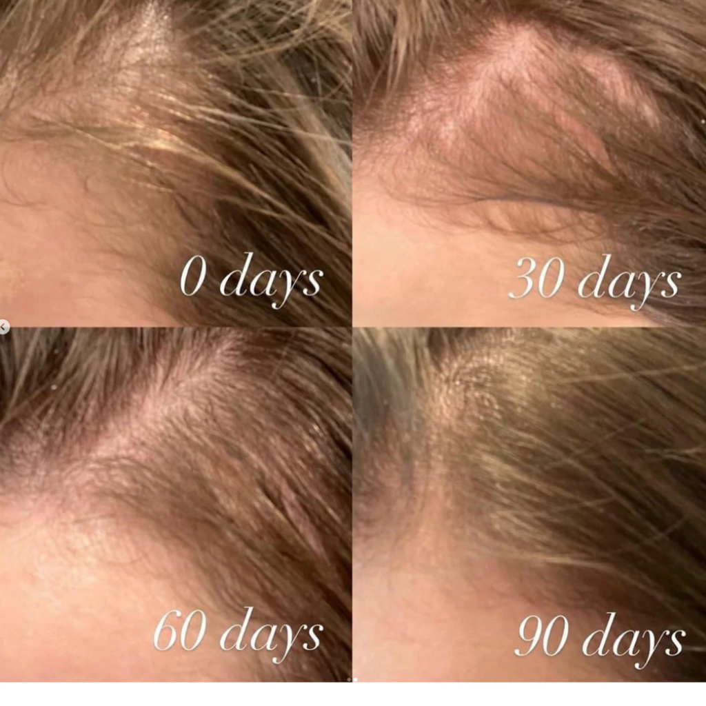 The Power Fol Multi-Correctional Hair Treatment